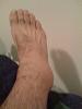 Click image for larger version. 

Name:	sprain.jpg 
Views:	61 
Size:	42.4 KB 
ID:	5724